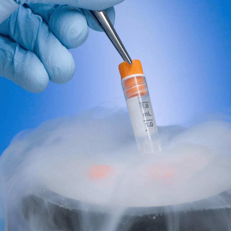 Egg Freezing Process, IVF