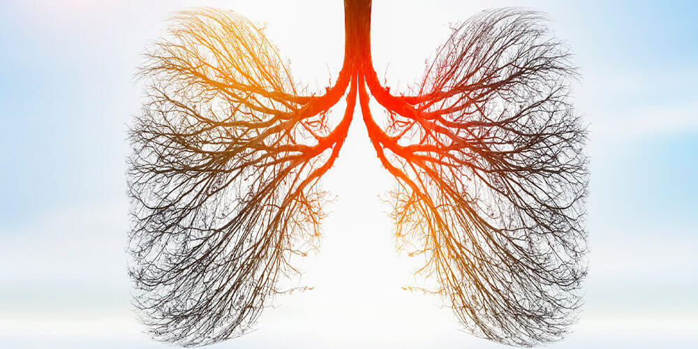 Akciğer Kanserinde Multidisipliner Tedavi