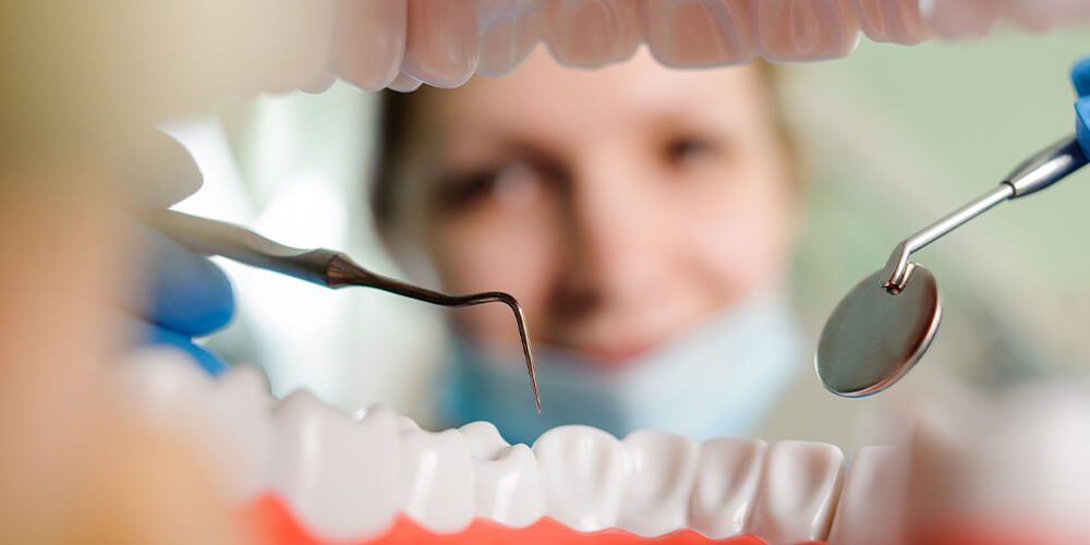 Diş Taşı Temizliği Nedir?