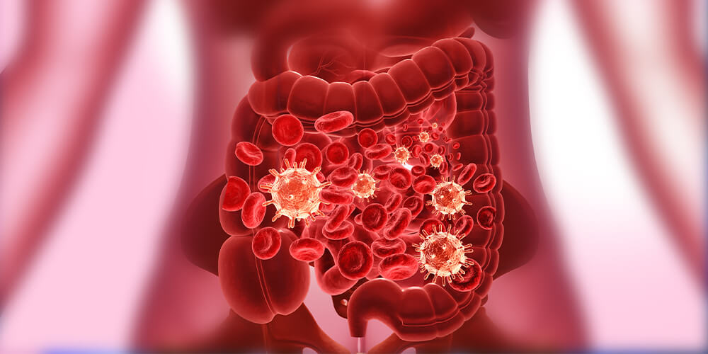 What Is Intestinal Infection?