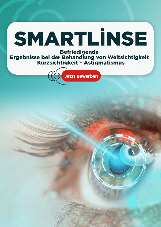 Smartlinse - Mobil - Banner