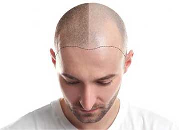 Kolan Hair