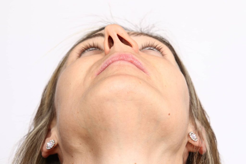 Septum Deviasyonu