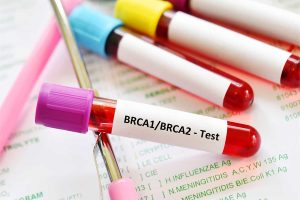 BRCA1 BRCA2 Test