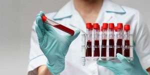 Anemi (Kansızlık) Nedir? Anemi Belirtileri ve Tedavi Yolları 1 Anemi Nedir - Anemi Belirtileri