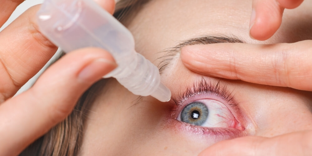 Göz Kızarklığı Neden Olur